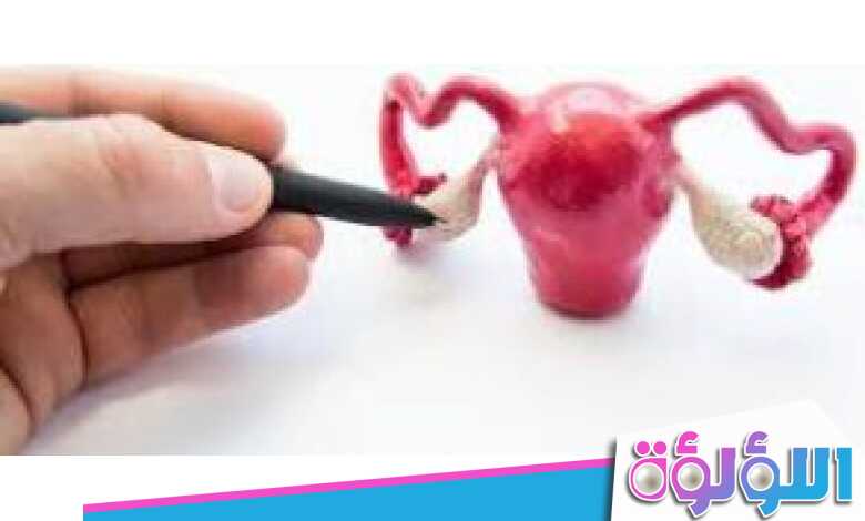 هل ينزل تكيس المبايض مع الدورة وكيفية تنظيمها